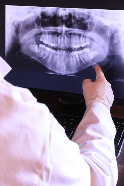 Best Emergency Denture Repair in Macon, GA
