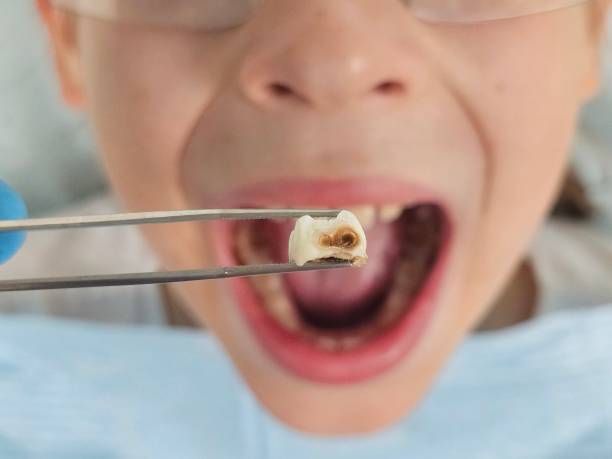 Best Weekend Emergency Dental Services in Macon, GA
